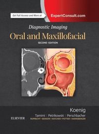 Diagnostic Imaging: Oral and Maxillofacial E-Book (e-bok)