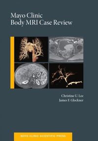 Mayo Clinic Body MRI Case Review (e-bok)