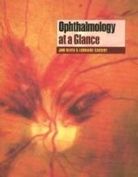 Ophthalmology at a Glance | 1:a upplagan