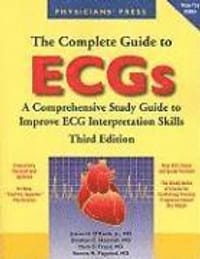The Complete Guide to ECGs